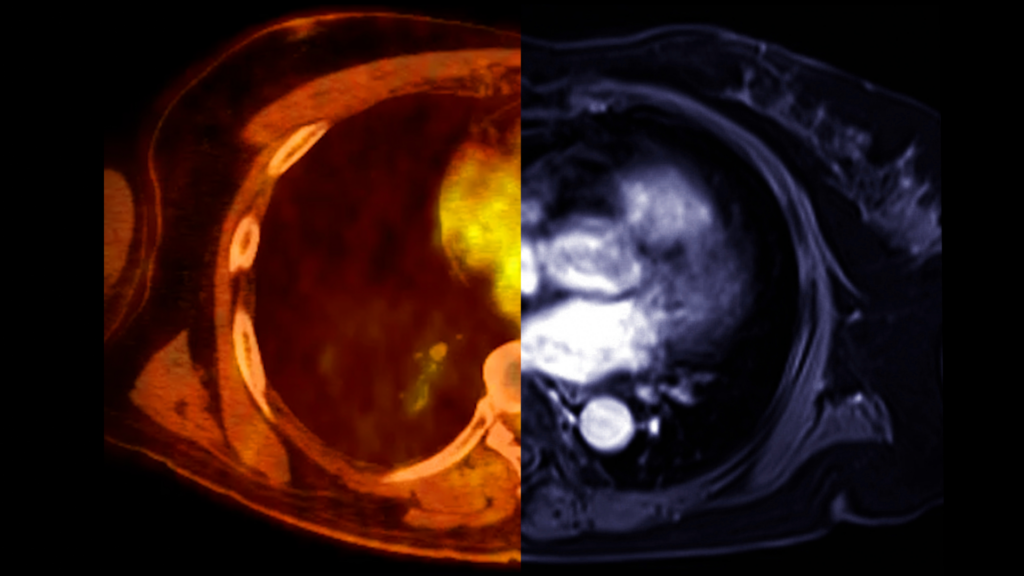 PET Scan Vs CT Scan Vs MRI Similarities And Differences