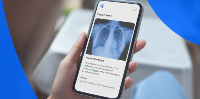 A person viewing an x-ray report on their phone using PocketHealth