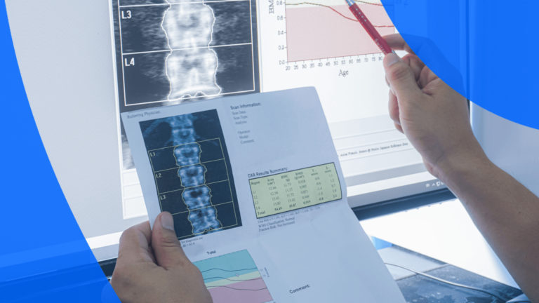 A Radiologist’s Guide to Getting a Bone Density Scan | PocketHealth