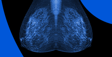 Mammograms And 5 Other Types Of Breast Screening Exams | PocketHealth