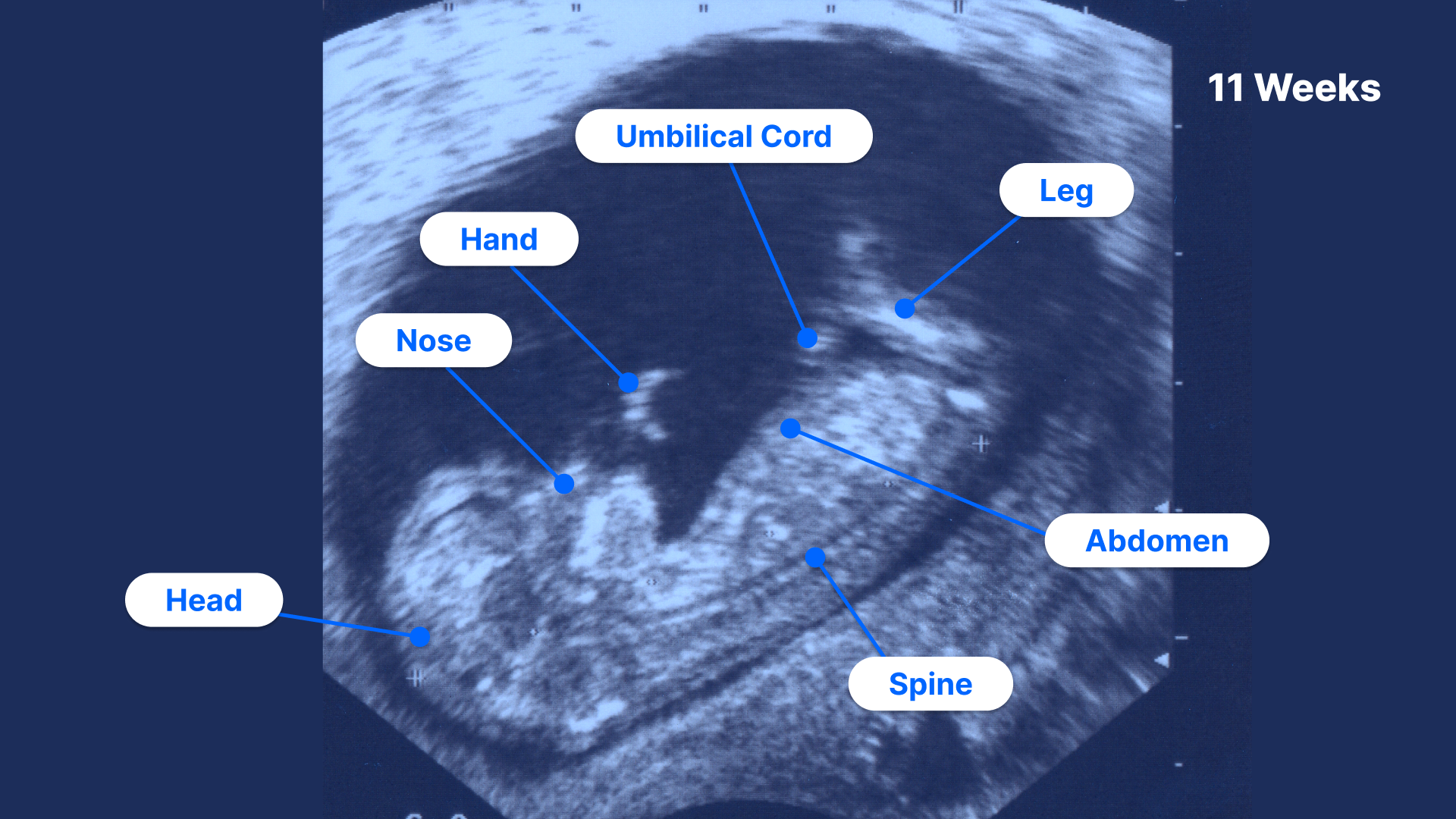 how-to-sleep-11-weeks-pregnant