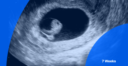 7 Weeks Pregnant Ultrasound | PocketHealth