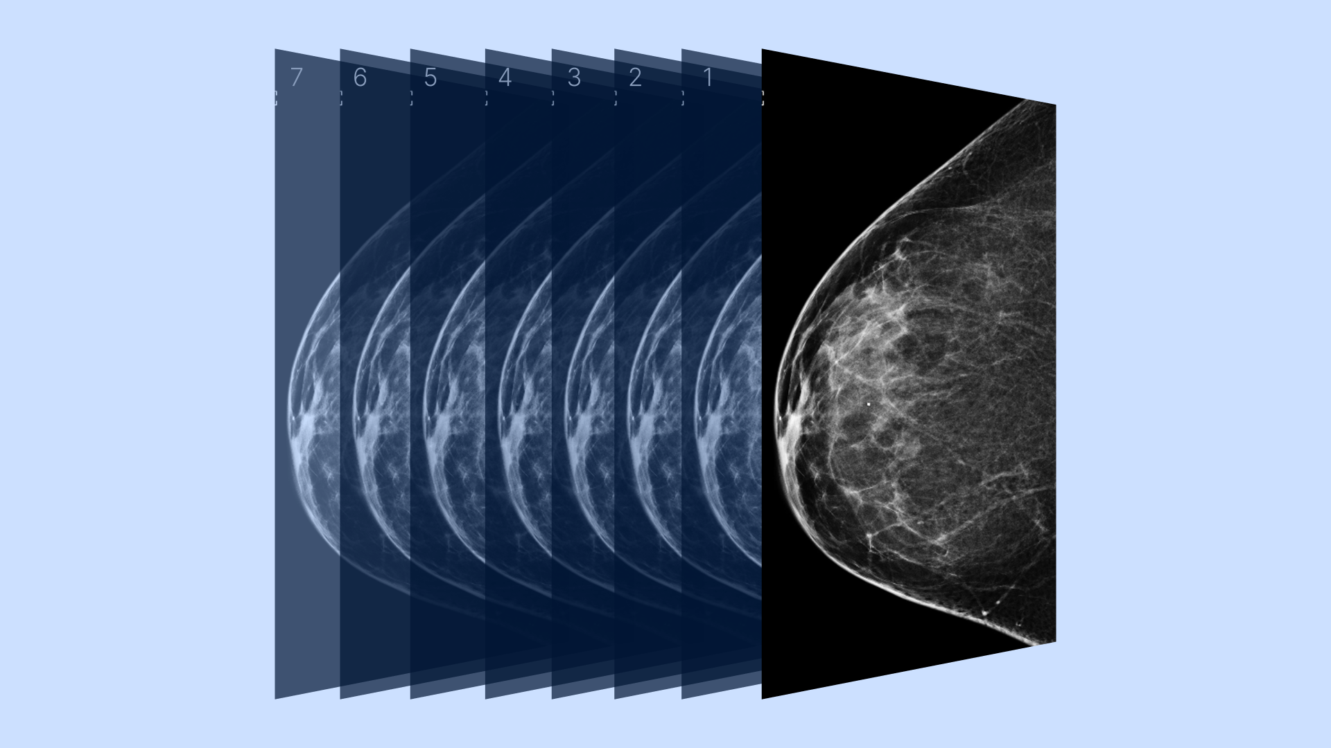 3d Mammogram Who Needs One What To Expect And More 2094