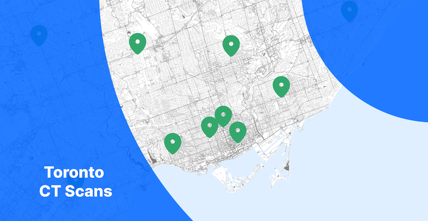 Toronto CT Scan Map