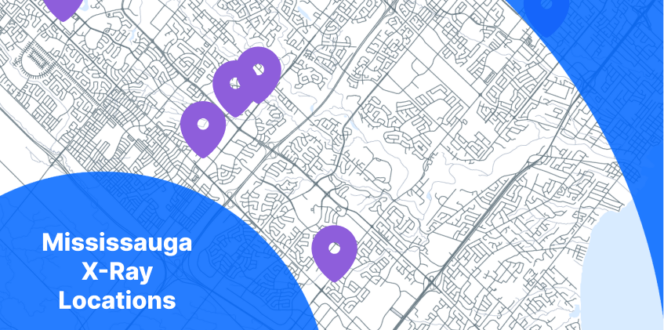 X-Ray Mississauga Map