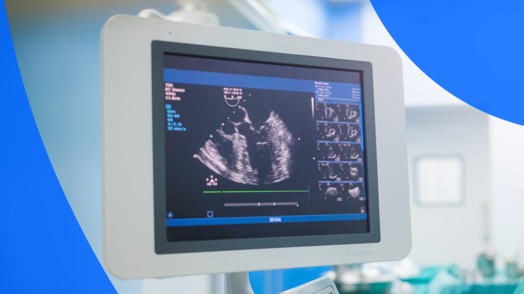 A screen showing an echocardiogram