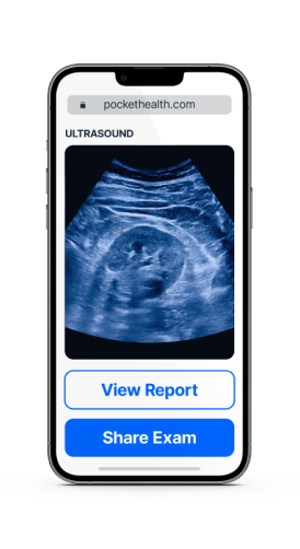 Ultrasound Results