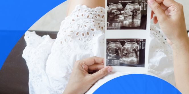 A pregnant woman getting an ultrasound scan