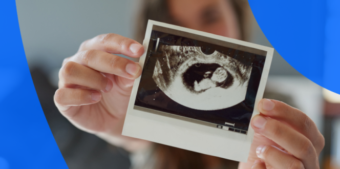 A person showing a pregnancy ultrasound picture