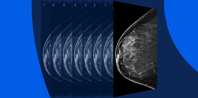 Mammogram